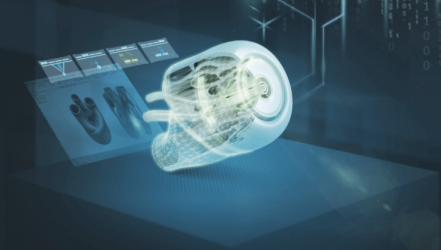 Siemens connects healthcare providers and medical designers to produce components through additive manufacturing
