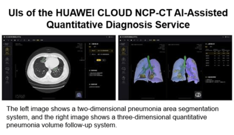 Huawei Cloud Launches AI-Assisted Diagnosis for Covid-19, Outputting CT Quantification Results in Seconds
