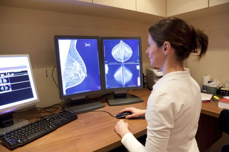 The Impact Of Artificial Intelligence In Transforming Breast Cancer Detection